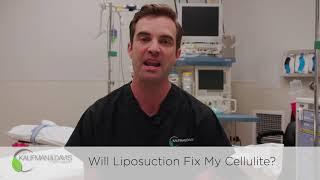 Will Liposuction Fix My Cellulite?