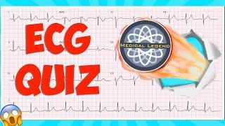 Are You A Medical Legend? Test Your Knowledge With This Ecgekg Quiz #electrocardiogram