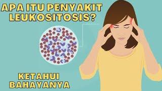 Ketahui Dampak Leukositosis Bahayakah Bagi Tubuh?