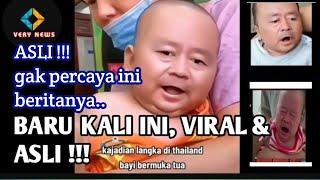 viral bayi berwajah tua terlahir di thailand dan penyebabnya #baby #bayiwajahtua #bayituathailand