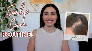 My Scalp Care Routine How I Stopped My Severe Seborrheic Dermatitis