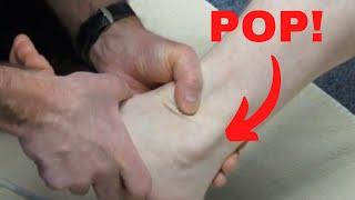 Peroneus longus subluxation How to treat it