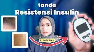 Tanda Resistensi Insulin & Penanganannya  dr. Vania Utami