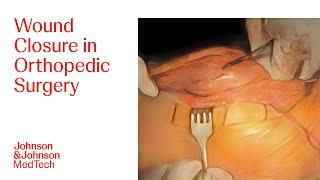 Importance of Secure Wound Closure in Knee Arthroplasty Procedure  J&J MedTech