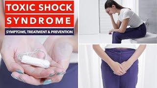 Toxic Shock Syndrome  Causes Symptoms & Prevention