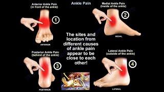 Ankle Pain - Everything You Need To Know - Dr. Nabil Ebraheim