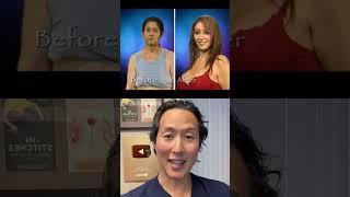 Doctor Reacts to THE SWAN Plastic Surgery Reality Show #theswan #plasticsurgerybeforeandafter