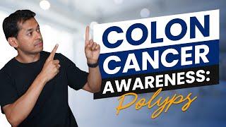 Unveiling the Mystery of Colon Cancer What You Need to Know About Polyps