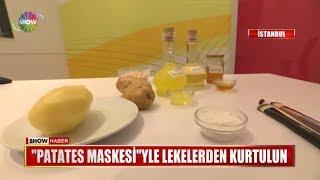 Patates maskesiyle lekelerden kurtulun