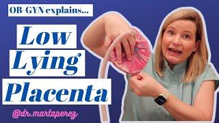 Low Lying Placenta Explained Risks Sex Exercise C-section vs Vaginal birth Marginal previa