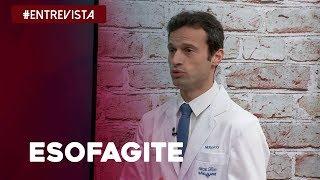 Tudo o que você precisa saber sobre Esofagite