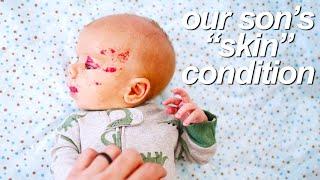 Whats Wrong with Your Babys Face?? addressing comments about our newborn sons hemangiomas