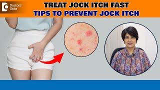 Jock Itch Tinea Cruris Best ways to avoid Itching Down There - Dr. Rasya Dixit Doctors Circle