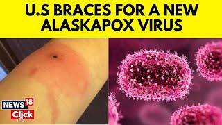 Alaskapox  New Virus Sparks Scare In US  Explained What Is Alaskapox?  N18V