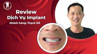 Review Trồng Implant Anh Thạch Đỗ Việt kiều Úc  Nha khoa Đại Nam