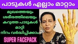 ചർമ്മത്തിലെ കറുത്ത പാടുകൾ മാറ്റാൻ  face pack to remove dark spots & pigmentation malayalam #melasma