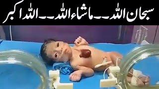 See Allahs miracle where a baby was born with his heart outside his chest  Subhan Allah  Avais