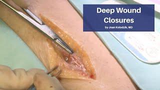 Deep Wound Closures  The Cadaver-Based Suturing Course