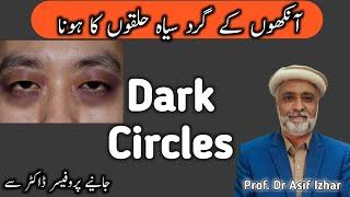 Dark Circles Ka Ilaj  Home Remedies For Dark Circles  Dark Circle in urdu  Dark Circles Ka Reason