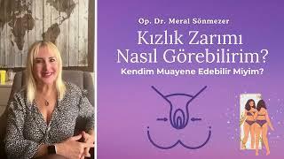 Kızlık Zarımı  Nasıl Görebilirim? - Op. Dr. Meral Sönmezer