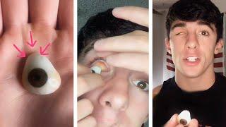 What Its Like To Have A Prosthetic Eye