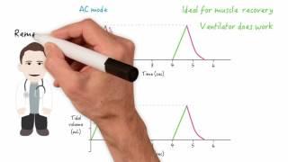 Assist control AC and synchronized intermittent mandatory ventilation SIMV modes