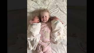 Twins   Revealed To Family At Birth