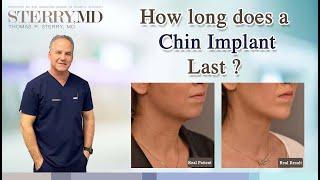 How Long Does a Chin Implant Last?