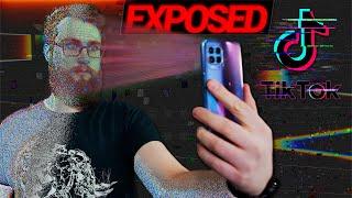 TikTok EXPOSED Bald VERBOTEN?