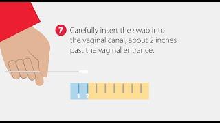 How to Collect a Vaginal Swab Sample  Step-by-Step Guide