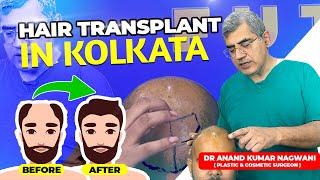 Cheapest Hair Transplant Cost  Best Hair Transplant In Kolkata  Cosmo Aid