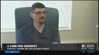 Possible Breakthrough In Crohns Disease