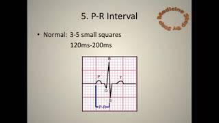 ECG Electro-cardio-gram