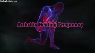 Arthritis Healing Frequency - {Swelling & Tenderness Healing}  1 Hour Pure Binaural Sound Therapy
