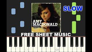 SLOW piano tutorial THIS IS THE LIFE by Amy McDonald 2007 with free sheet music pdf