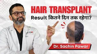 Hair Transplant Result कितने दिन तक रहेगा ?  Dr. Sachin Pawar Hair Transplant Surgeon  HairMD Pune
