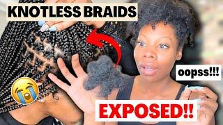 How Your KNOTLESS BRAIDS Are Damaging Your Hair Follicles?