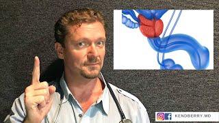 Prostate Health Your Diet Matters? BPH-2024