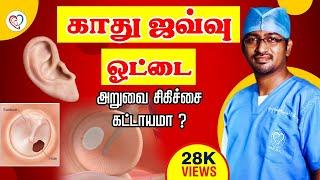 காது ஜவ்வு ஓட்டை-அறுவை சிகிச்சை கட்டாயமா ?  Ear drum perforation  Dr. Manoj ENT Speciality Centre