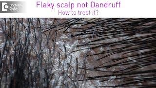 Get rid of itchy white flaky scalp which is not dandruff - Dr. Rashmi Ravindra Doctors Circle