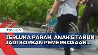 Anak 5 Tahun di Kota Pematangsiantar Sumut Jadi Korban Pemerkosaan hingga Terluka Parah