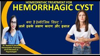 अंडाशयovary में सिस्ट को गलाने की होम्योपैथिक दवायें Hemorrhagic Cyst homeopathic Treatment