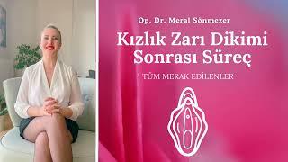 Kızlık Zarı Dikimi Sonrası Süreç- Tüm Merak Edilenleri Anlattık