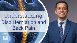 Disc Herniation Symptoms Treatment Risk Factors & Causes  Mass General Brigham