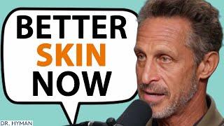 THE ROOT CAUSES Of Acne & How To Prevent It  Mark Hyman