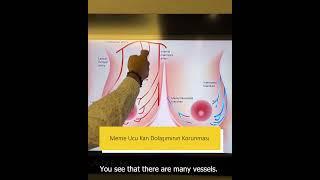 Protection of Nipple Blood Circulation  Dr.Erdem GUVEN