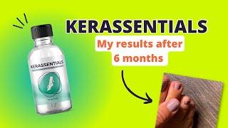 Kerassentials Review My 6 Month Update