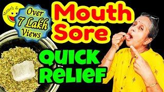 How to Heal Mouth Sores Faster Quickly Heal Mouth Sores Naturally