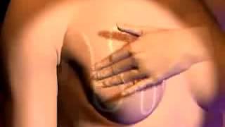 Breast Cancer Self Examination  Early Breast Cancer Detection