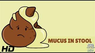 Mucus In Stool Everything You Need To Know